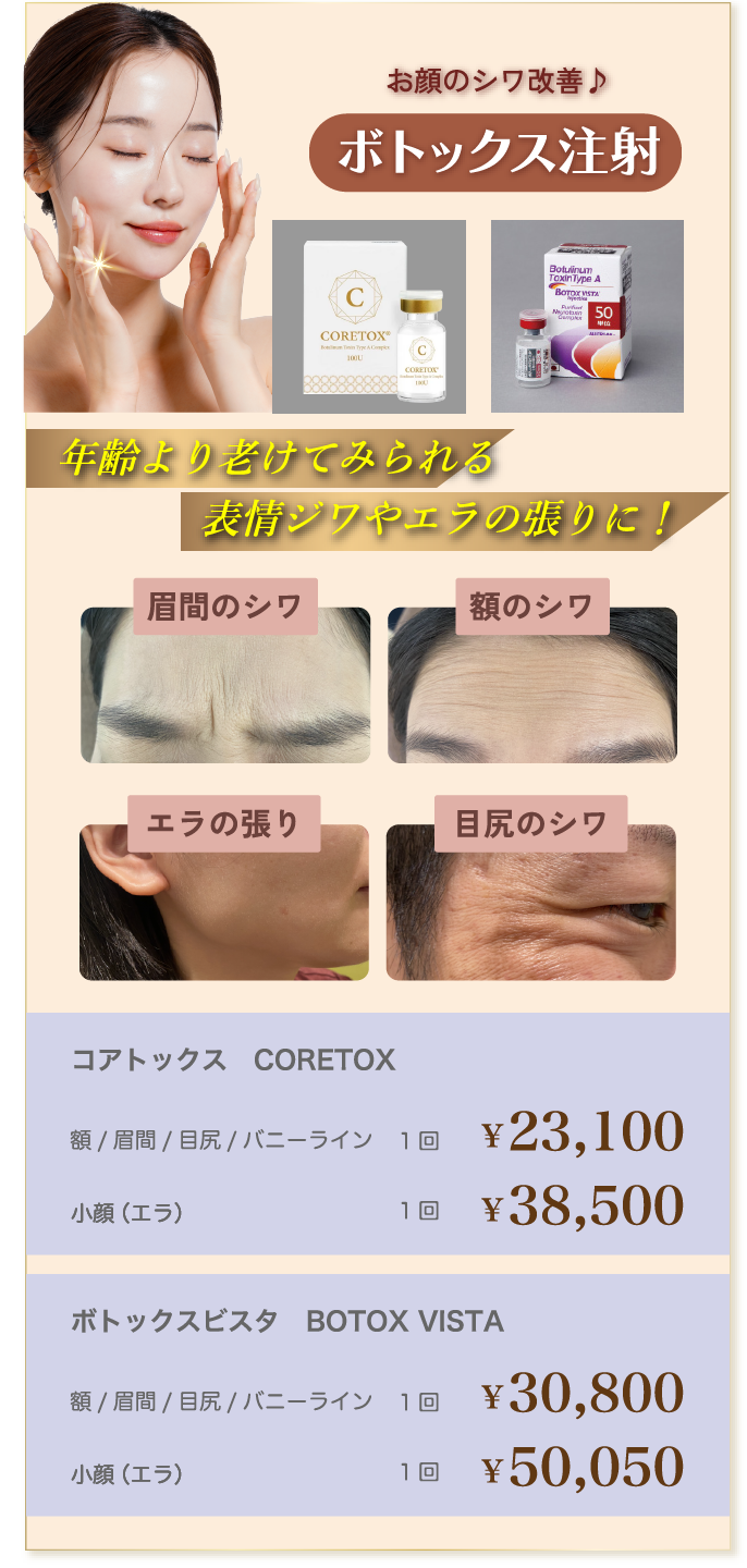 ボトックス注射