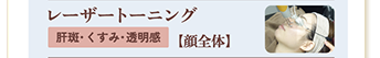 レーザートーニング