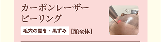 カーボンレーザーピーリング