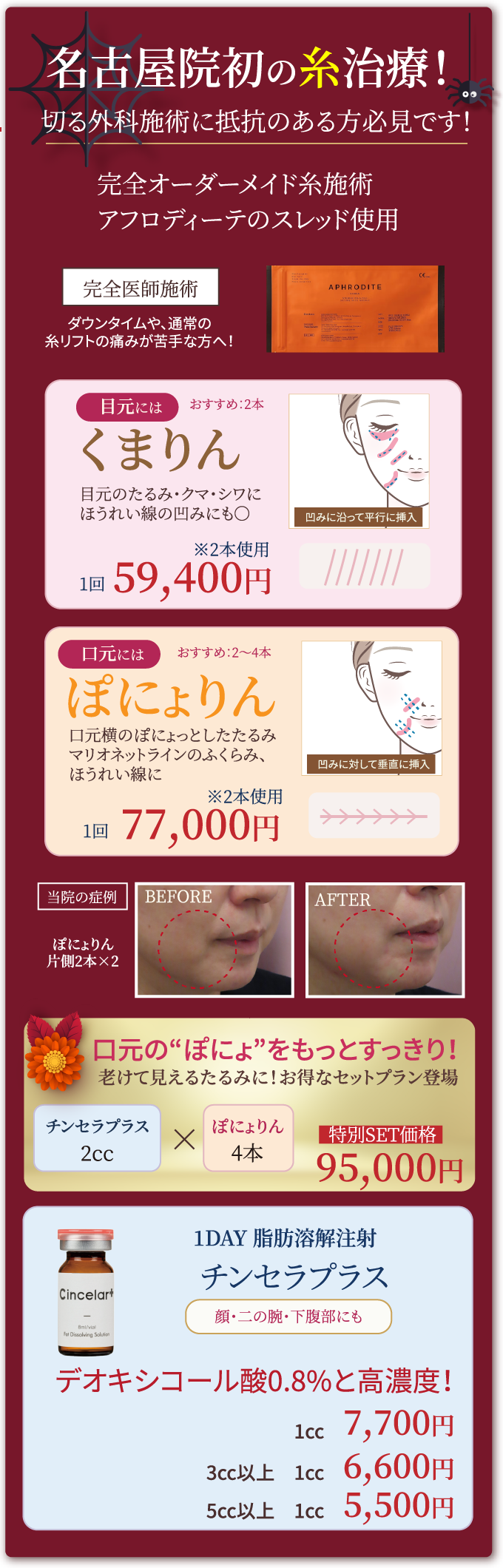 名古屋院初の糸治療