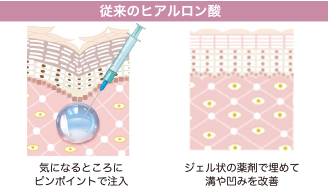 従来のヒアルロン酸